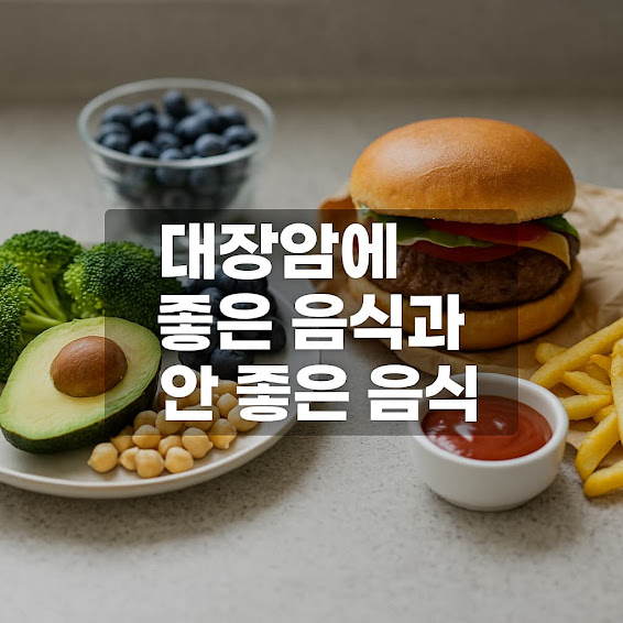 대장암에 좋은 음식과 안 좋은 음식