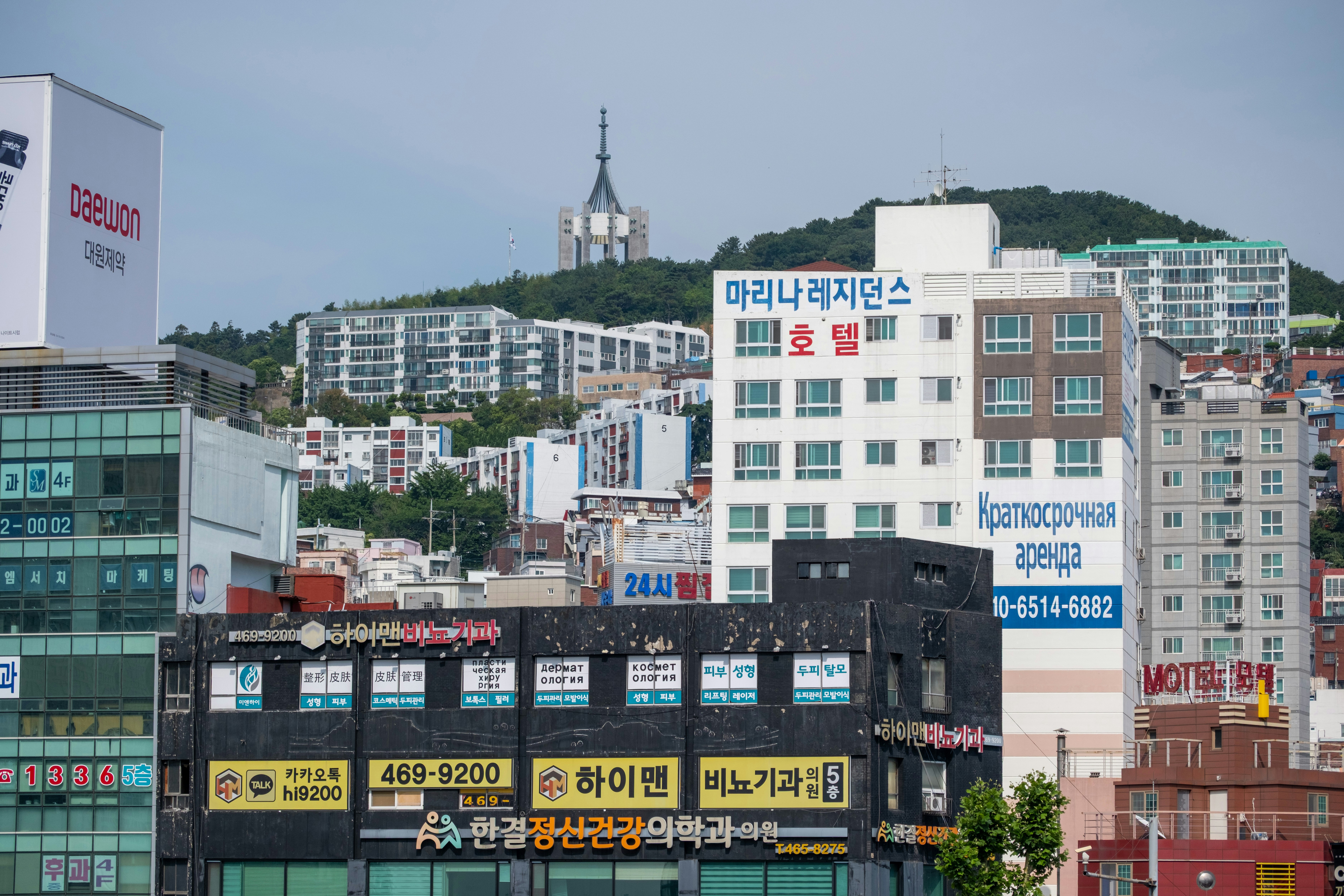 사랑니의 단순, 복잡, 완전 매복 유형을 보여주는 3D CT 스캔 이미지