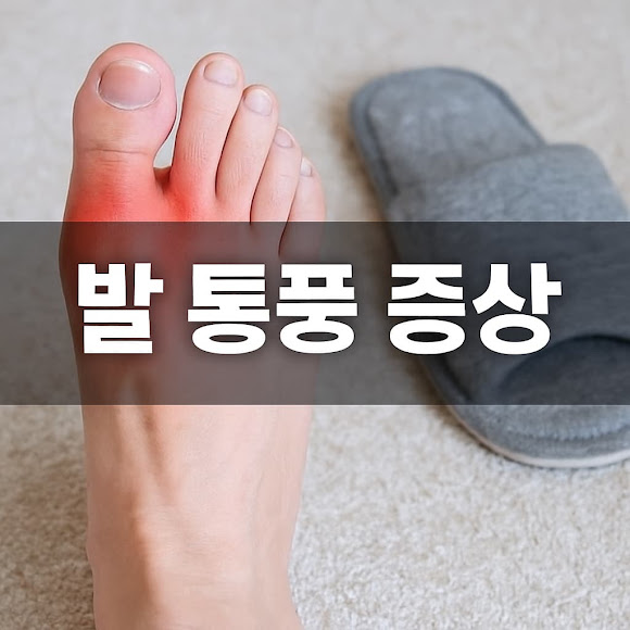 발 통풍 증상