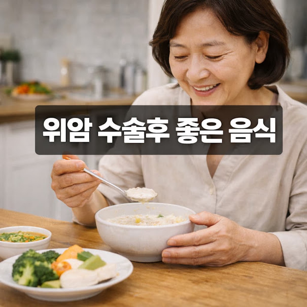 위암 수술후 좋은 음식