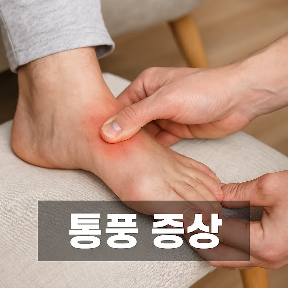 통풍 증상